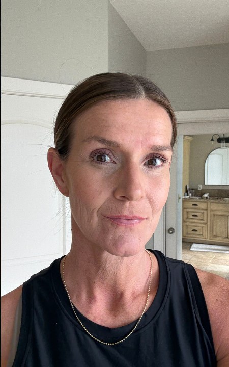 The same face after one layer of Derma Muse