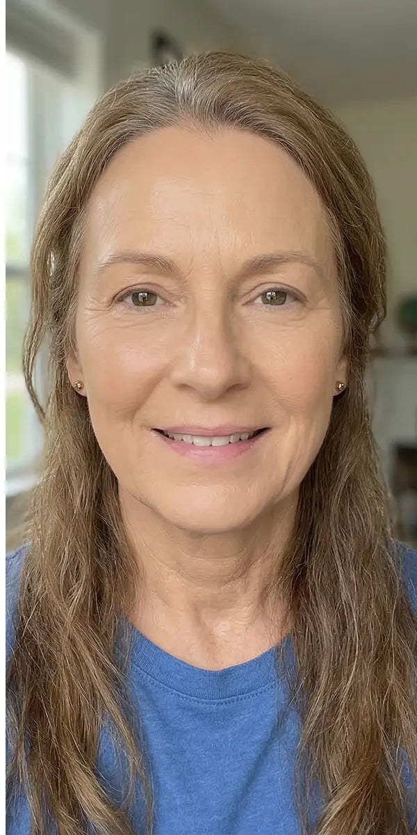 The same face after one layer of Derma Muse